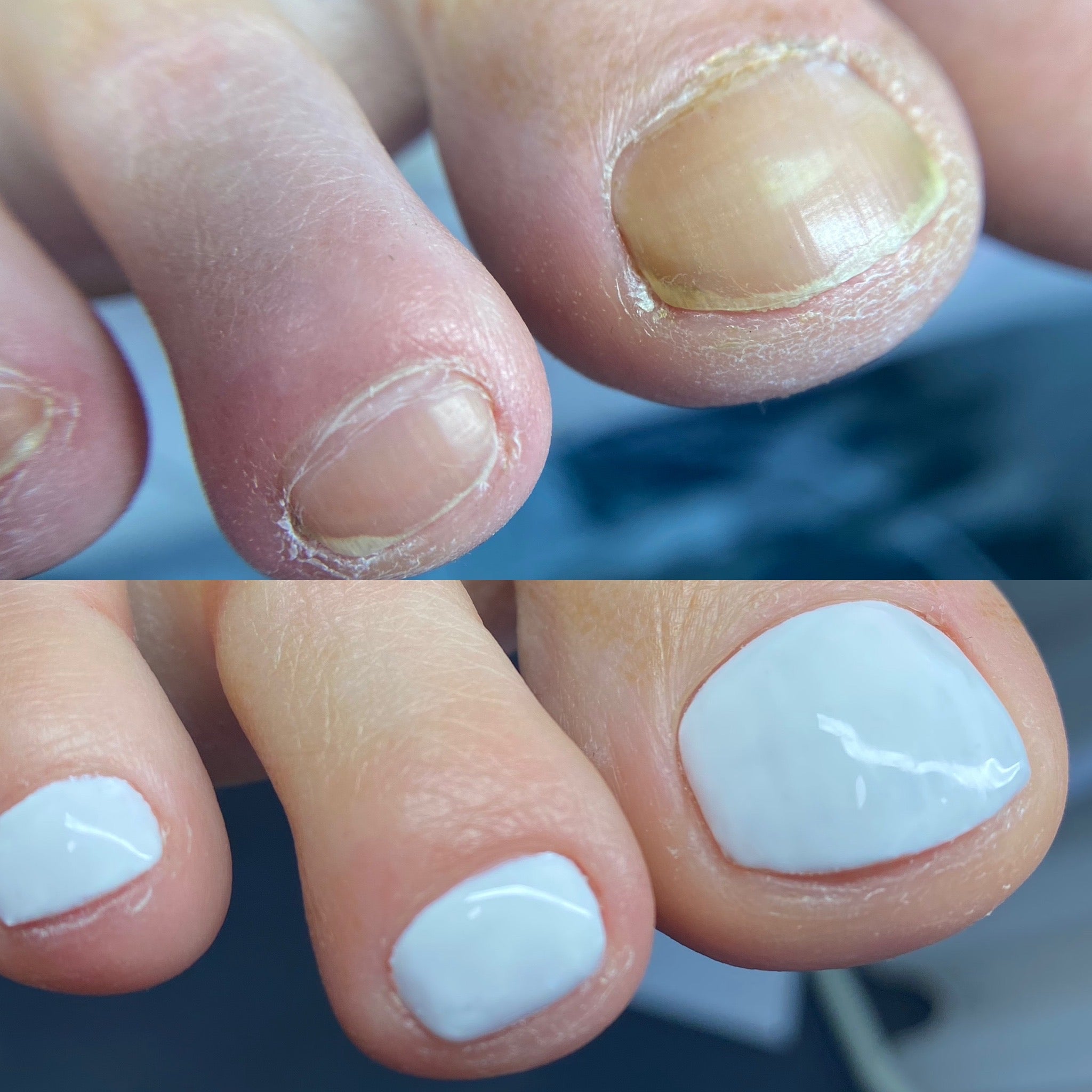 Before & after of luxury dry e-file pedicure with clean cuticle work & white gel polish finish.