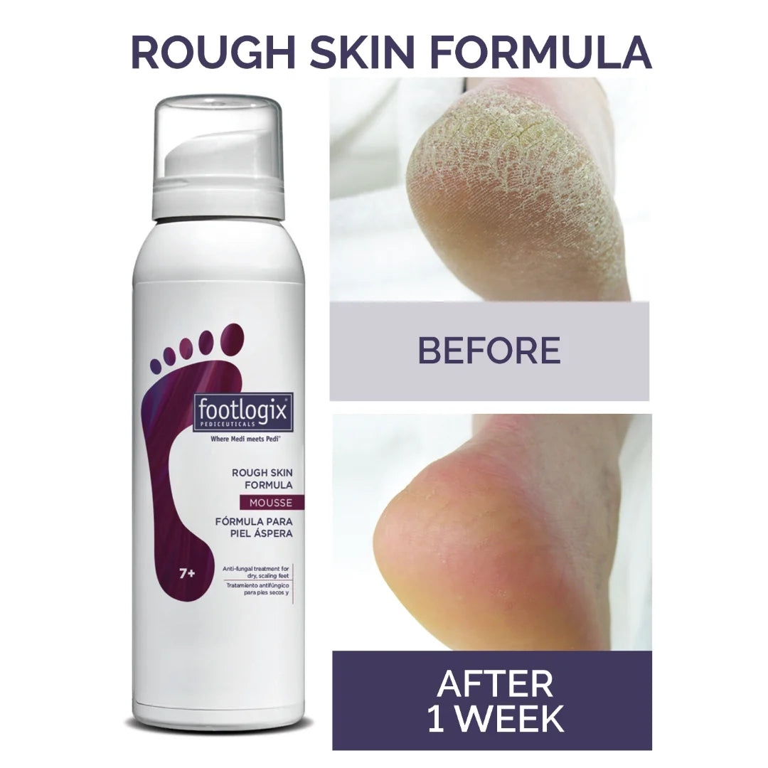 Rough Skin Mousse