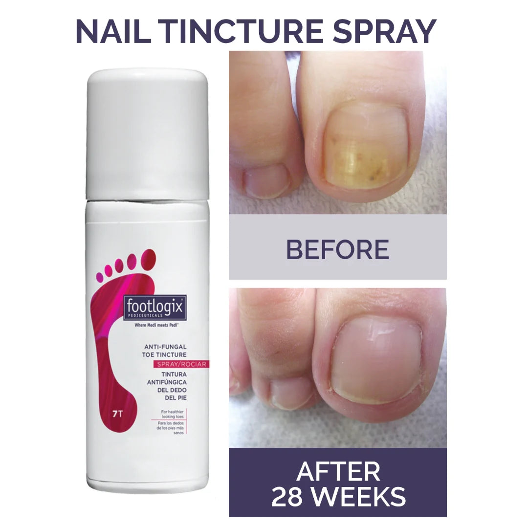 Nail Tincture Spray