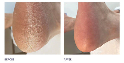 Ultimate At Home Foot Care Combo