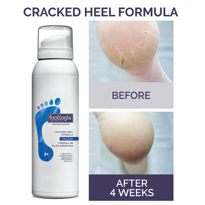 Cracked Heels Mousse