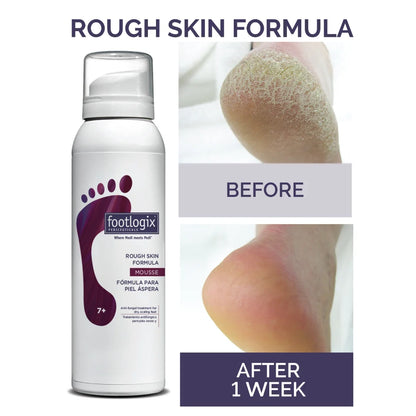 Rough Skin Mousse